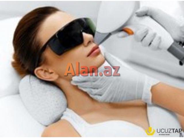 Lazer ustasi teleb olunur