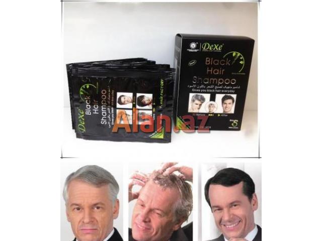 Qara shanpun tedricen sac qaraldir