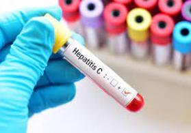 Hepatit  virusları   A , B.  C ,  D  və E