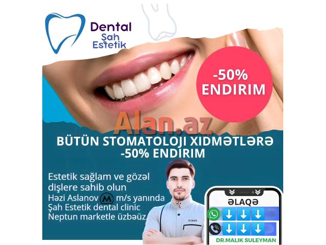 Stomatoloji xidmətlər 50% endirim 7 gün